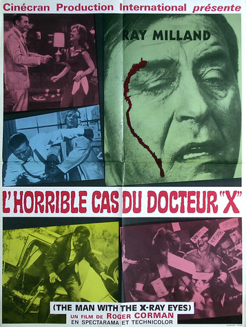 L'Horrible cas du Dr X